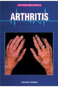 Arthritis