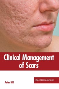 Clinical Management of Scars