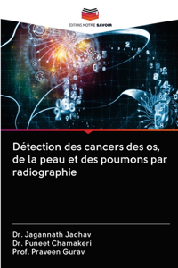 Détection des cancers des os, de la peau et des poumons par radiographie