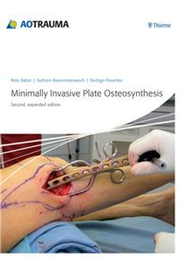 AO Minimally Invasive Plate Osteosynthesis (MIPO)