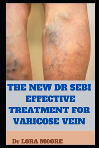New Dr Sebi Effective Treatment for Varicose Vein