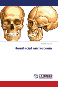 Hemifacial microsomia