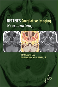 Netter's Correlative Imaging: Neuroanatomy with Access Code