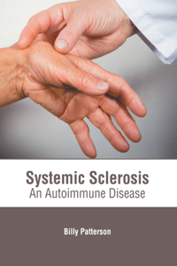 Systemic Sclerosis: An Autoimmune Disease