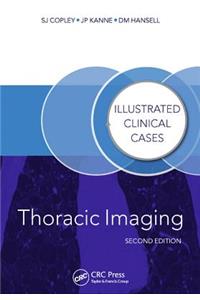 Thoracic Imaging