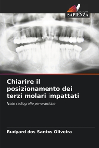 Chiarire il posizionamento dei terzi molari impattati