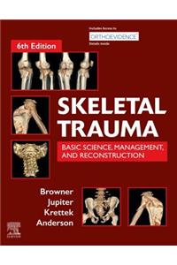 Skeletal Trauma E-Book