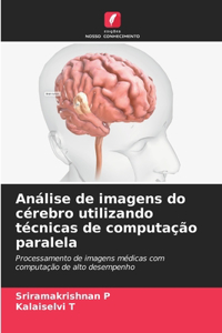 Análise de imagens do cérebro utilizando técnicas de computação paralela