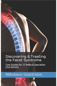 Discovering & Treating the Facet Syndrome