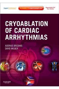 Cryoablation of Cardiac Arrhythmias