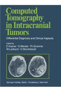 Computed Tomography in Intracranial Tumors: Differential Diagnosis and Clinical Aspects