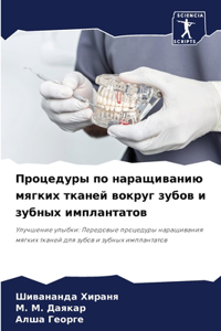 Процедуры по наращиванию мягких тканей k