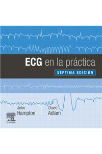 ECG En La Práctica