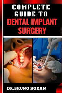 Complete Guide to Dental Implant Surgery
