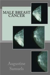 Male Breast Cancer