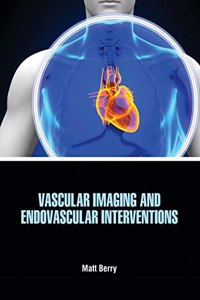 Vascular Imaging And Endovascular Interventions