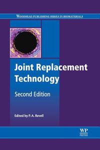 Joint Replacement Technology