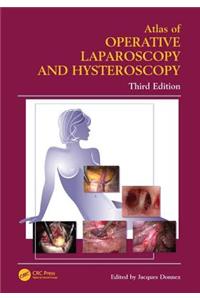 Atlas of Operative Laparoscopy and Hysteroscopy