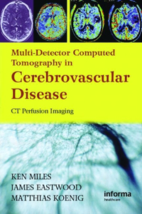 Multidetector Computed Tomography in Cerebrovascular Disease