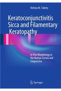 Keratoconjunctivitis Sicca and Filamentary Keratopathy