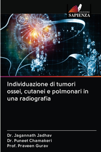 Individuazione di tumori ossei, cutanei e polmonari in una radiografia