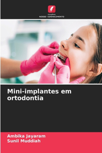 Mini-implantes em ortodontia