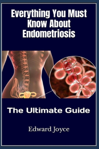 Everything You Must Know About Endometriosis