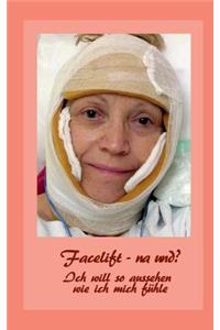 Facelift - na und?