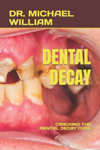 Dental Decay