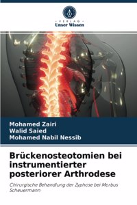 Brückenosteotomien bei instrumentierter posteriorer Arthrodese