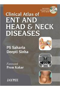 Clinical Atlas of Ent and Head & Neck Diseases