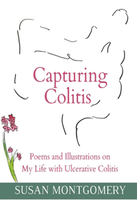 Capturing Colitis