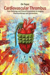 Cardiovascular Thrombus: From Pathology and Clinical Presentations to Imaging, Pharmacotherapy and Interventions