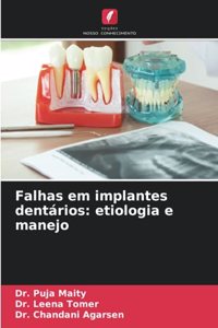 Falhas em implantes dentários