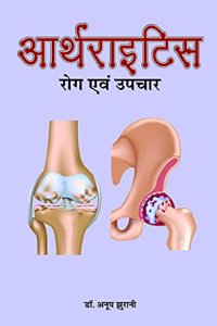 Arthritis Rog evam Upchar