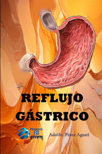 Reflujo gástrico