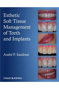 Esthetic Soft Tissue Management of Teeth and Implants