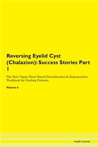 Reversing Eyelid Cyst (Chalazion): Succe