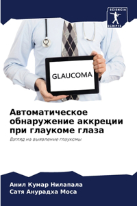 Автоматическое обнаружение аккреции при