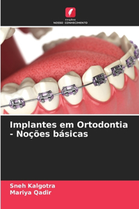 Implantes em Ortodontia - Noções básicas