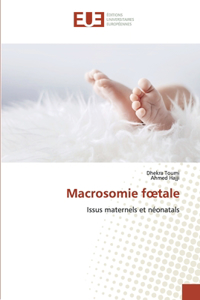 Macrosomie foetale