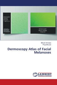 Dermoscopy Atlas of Facial Melanoses