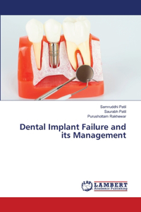 Dental Implant Failure and its Management
