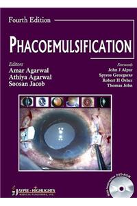 Phacoemulsification Surgery