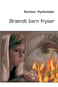 Brændt barn fryser
