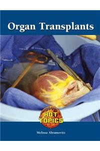 Organ Transplants