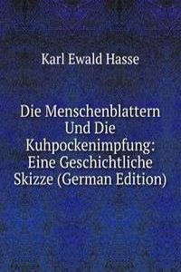 Die Menschenblattern Und Die Kuhpockenimpfung: Eine Geschichtliche Skizze (German Edition)