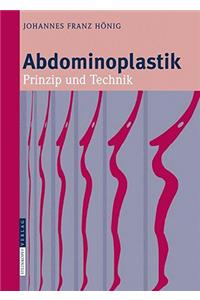 Abdominoplastik