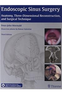 Endoscopic Sinus Surgery: Anatomy, Three - Dimensional Reconstruction andSurgical Technique