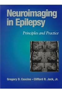 Neuroimaging in Epilepsy: Principles & Practice